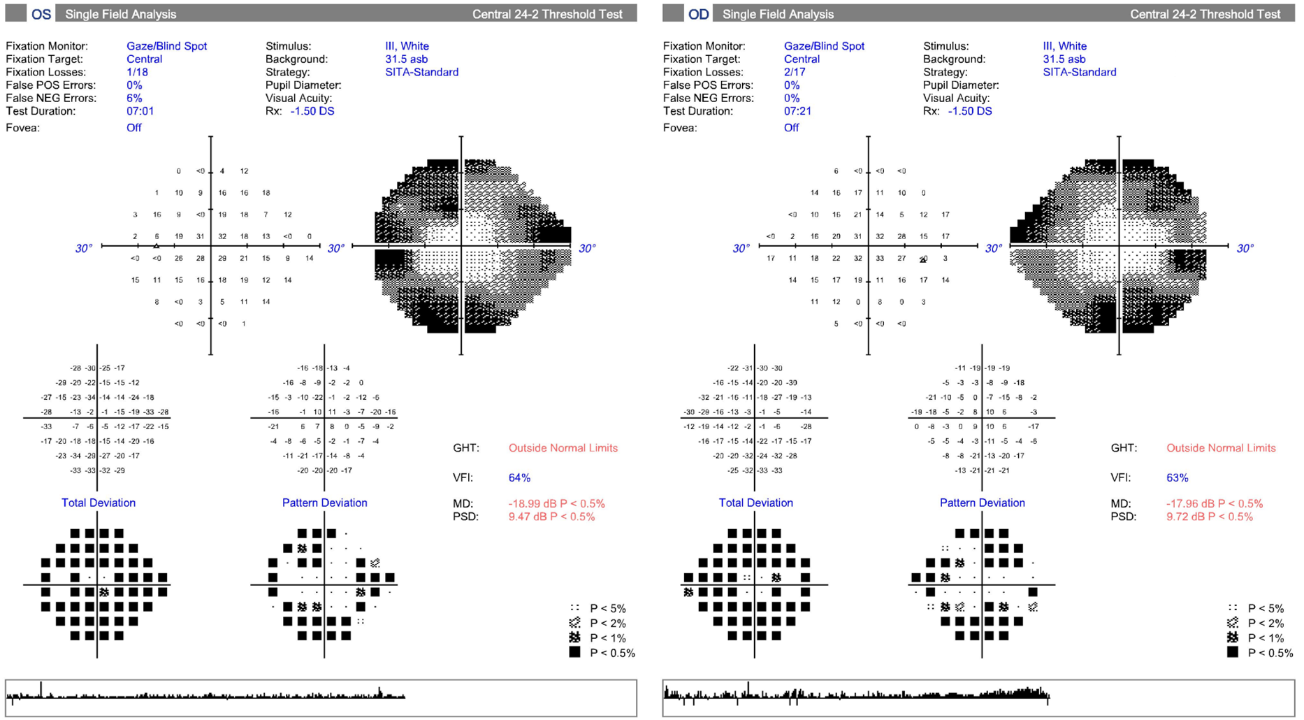 Retinitis Pigmentosa (Extract from the CFEH Atlas) Centre for Eye Health